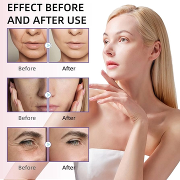 Centella Brightening Serum - Remove scars, dark spots & pigmentation